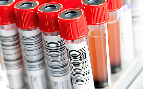 RFID(bio)?zi)ܷȫlδa